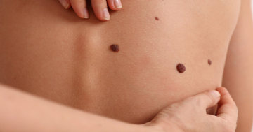 nei sulla schiena di bambino